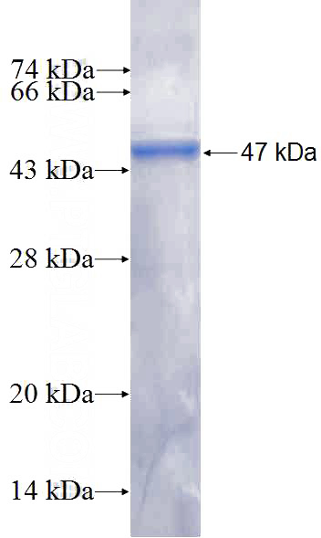 Recombinant Human ANKRD46 SDS-PAGE