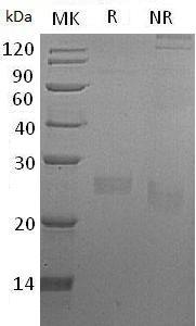 Human FAM3D/UNQ567/PRO1130 (His tag) recombinant protein