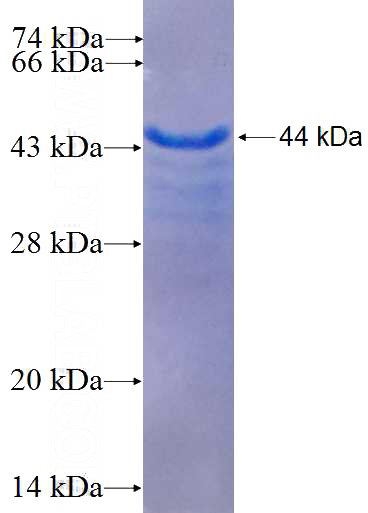 Recombinant Human C17orf49 SDS-PAGE
