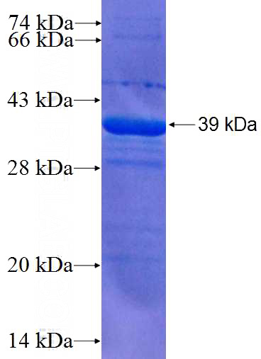 Recombinant Human ZWILCH SDS-PAGE