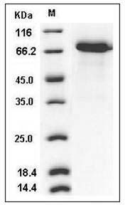 Human WFIKKN2 / GASP-1 Protein (His Tag) SDS-PAGE