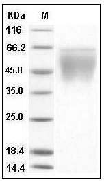 Mouse CD86 / B7-2 Protein (His Tag) SDS-PAGE