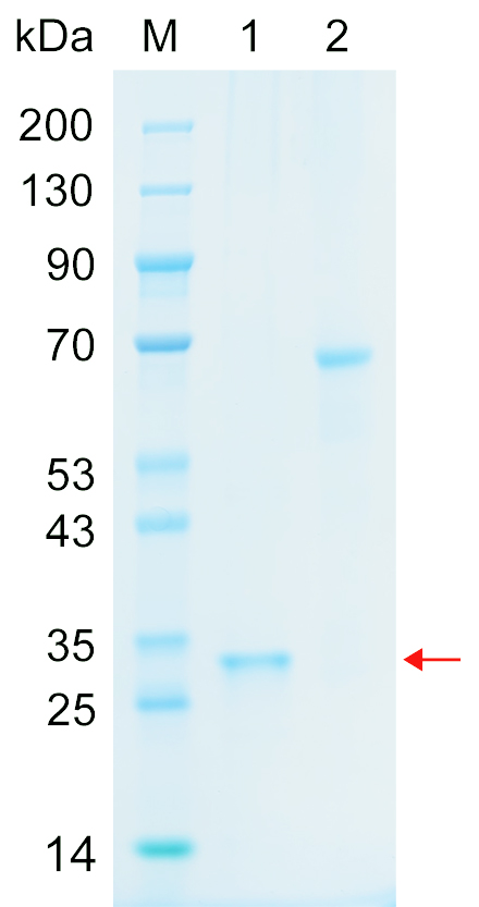Recombinant ZC12A protein (His tag) SDS-PAGE