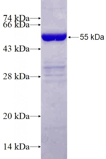 Recombinant Human SPZ1 SDS-PAGE