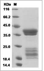 Human IL17A & IL17F Heterodimer Protein (His Tag) SDS-PAGE
