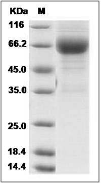 Rat IL4R / Il4ra Protein (Fc Tag) SDS-PAGE