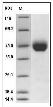 Influenza A H10N9 (A/duck/HongKong/562/1979) Hemagglutinin Protein (HA1 Subunit) (His Tag) SDS-PAGE
