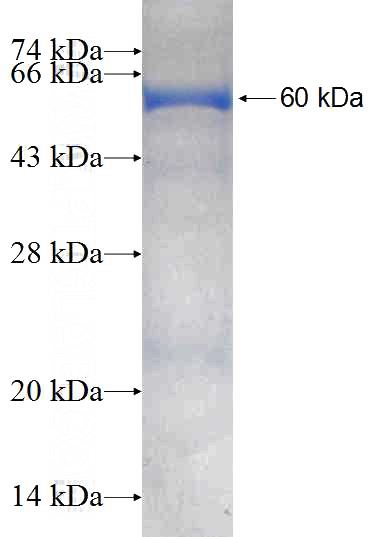 Human FH Recombinant protein (GST tag)