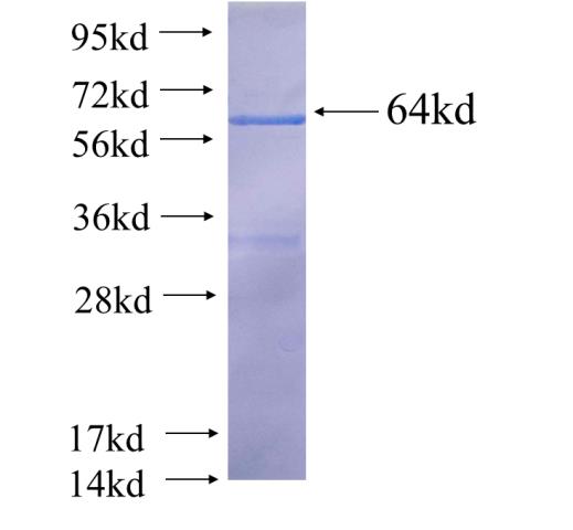 Recombinant human GDE1(Full length) SDS-PAGE