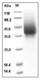 Human RSV (A, rsb1734) glycoprotein G / RSV-G Protein (93% Homology) (His Tag) SDS-PAGE