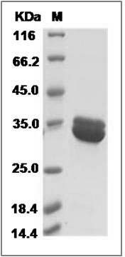 Human Annexin A8 / ANXA8 Protein (His Tag) SDS-PAGE