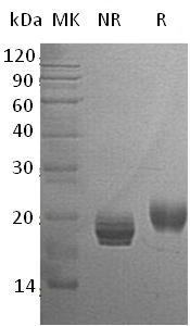 Human GM2A (His tag) recombinant protein