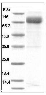 Mouse Growth Hormone Receptor / GHR / GHBP Protein (His & Fc Tag) SDS-PAGE