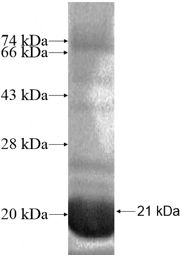 Recombinant Human WDR82 SDS-PAGE