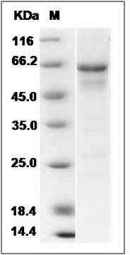 Human ERN1 / IRE1 Protein (aa 465-977) SDS-PAGE