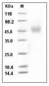Mouse NEGR1 Protein (His Tag) SDS-PAGE