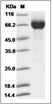 Influenza A H7N9 (A/Anhui/1/2013) Neuraminidase / NA (Active) (His Tag) SDS-PAGE