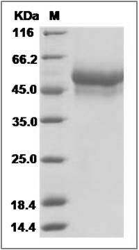 Rat LAG3 / CD223 / Lymphocyte activation gene 3 Protein (His Tag) SDS-PAGE