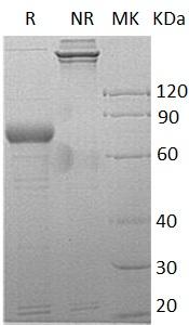 Human SIRPG/SIRPB2 (Fc tag) recombinant protein