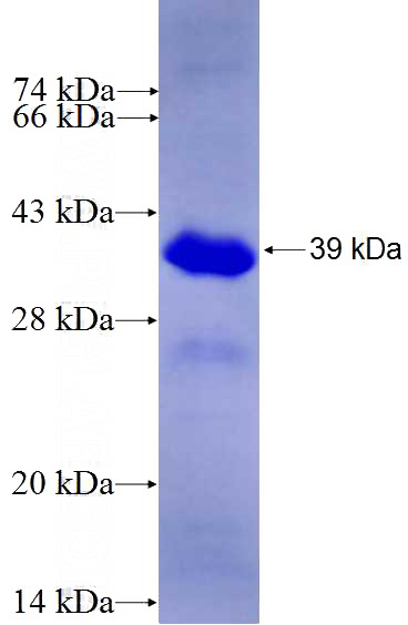 Recombinant Human MED23 SDS-PAGE