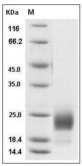 Mouse CD302 / CLEC13A Protein (His Tag) SDS-PAGE