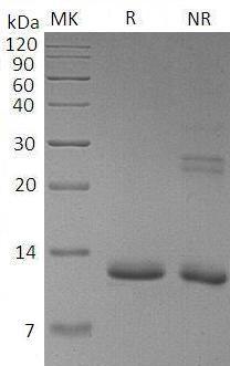 Mouse S100a11/S100c (His tag) recombinant protein