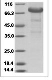 Rabbit NGFR/P75 Protein 14121