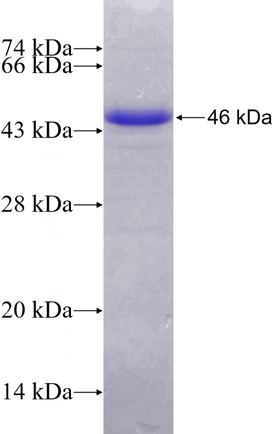 Recombinant Human PPP1R13L SDS-PAGE