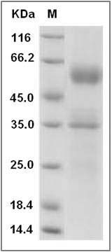 Mouse FLT3L / Flt3 ligand Protein (Fc Tag) SDS-PAGE