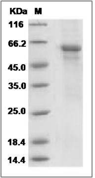 Mouse IL27 / Interleukin-27 Protein (His Tag) SDS-PAGE
