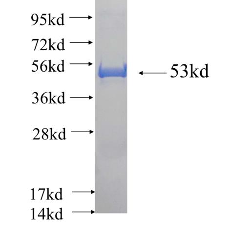 Recombinant human CDC34 SDS-PAGE