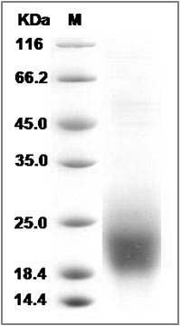 Cynomolgus CD53 Protein (aa 107-181, His Tag) SDS-PAGE