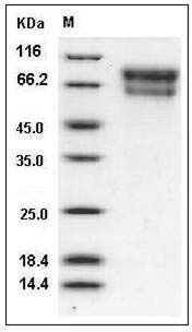 Mouse SerpinA10 / ZPI Protein (His Tag) SDS-PAGE