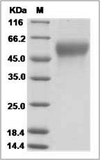 Influenza A H18N11 (A/flat-faced bat/Peru/033/2010) Hemagglutinin / HA1 Protein (His Tag)