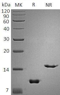 Mouse Scgb1a1/Cc10/Ugb/Utg (His tag) recombinant protein