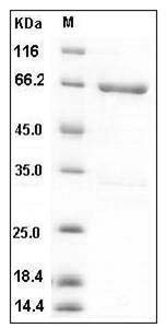 Mouse MKK4 / MEK4 / MAP2K4 Protein (His & GST Tag) SDS-PAGE