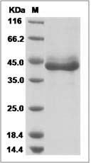 Human LALBA / Alpha-lactalbumin Protein (Fc Tag) SDS-PAGE