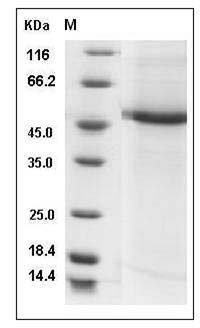 Human CST9L / Testatin Protein (Fc Tag) SDS-PAGE