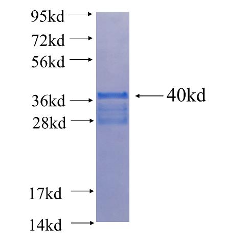 Recombinant human ONECUT1 SDS-PAGE