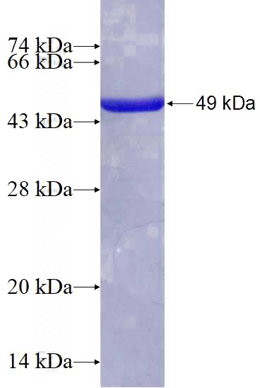 Recombinant Human ATP5O SDS-PAGE