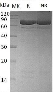 Human PADI4/PAD4/PADI5/PDI5 (His tag) recombinant protein