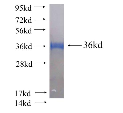 Recombinant human TMCO6 SDS-PAGE