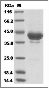Cynomolgus / Rhesus Fractalkine / CX3CL1 Protein (Fc Tag) SDS-PAGE