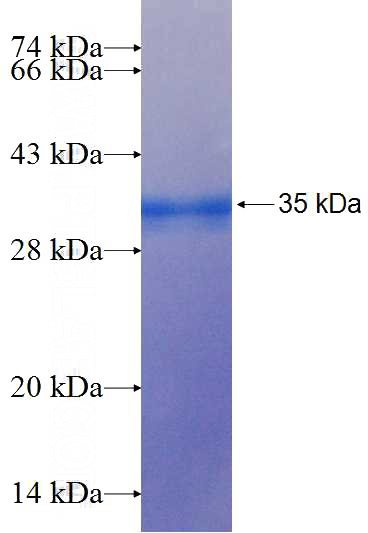 Recombinant Human NUPR1 SDS-PAGE