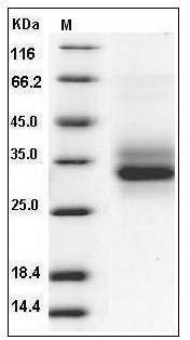 Mouse CLEC7A / Dectin-1 / CLECSF12 Protein (His Tag) SDS-PAGE