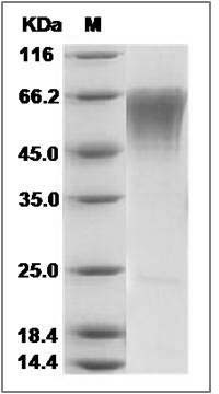 Human CLM-9 / TREM4 / CD300LG Protein SDS-PAGE