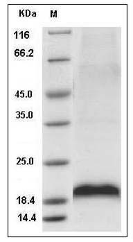 Mouse MANF / ARMET Protein (His Tag) SDS-PAGE