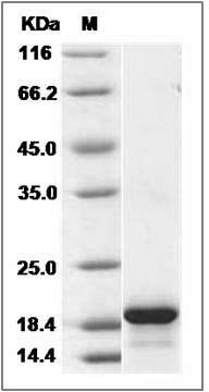 Human Pleiotrophin / PTN / HB-GAM Protein SDS-PAGE