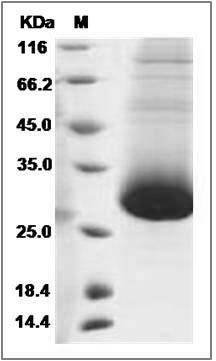 Cynomolgus CD90 / THY-1 Protein (His Tag) SDS-PAGE