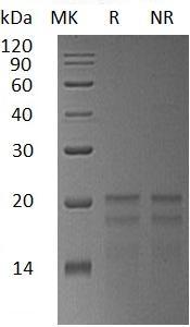 Human ZNHIT1/CGBP1/ZNFN4A1 (His tag) recombinant protein